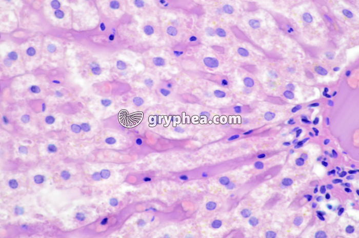 Foie injecté x160 - gryphea.org